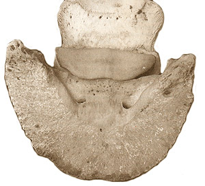 Pedal and navicular bones in horse's hoof